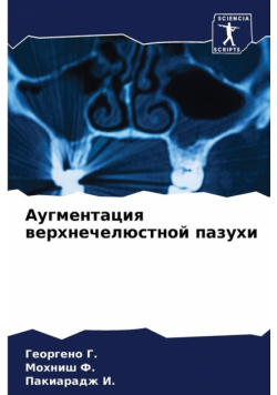 Аугментация верхнечелюстной пазухи