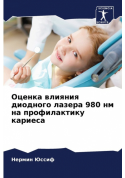 Оценка влияния диодного лазера 980 нм на профилактику кариеса