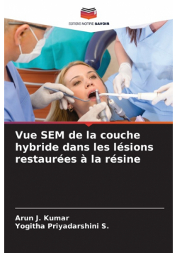 Vue SEM de la couche hybride dans les lésions restaurées à la résine