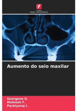 Aumento do seio maxilar