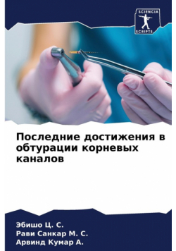 Последние достижения в обтурации корневых каналов