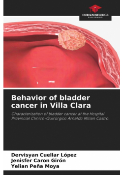 Behavior of bladder cancer in Villa Clara