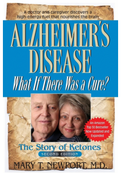 Alzheimer's Disease