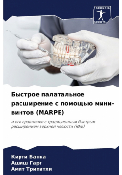 Быстрое Палатальное Расширение С Помощью Мини-Винтов (Marpe)