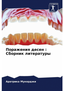 Поражения десен