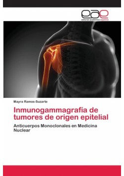 Inmunogammagrafía de tumores de origen epitelial