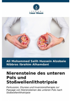 Nierensteine des unteren Pols und Stoßwellenlithotripsie