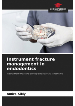 Instrument fracture management in endodontics