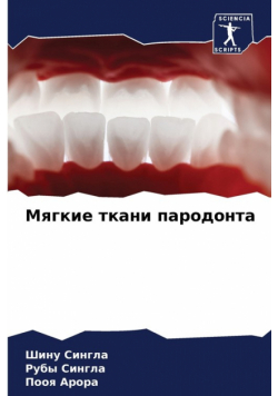 Мягкие ткани пародонта