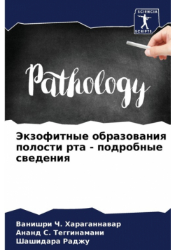 Экзофитные образования полости рта - подробные сведения