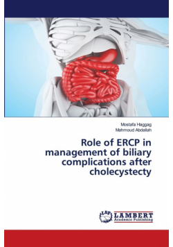 Role of ERCP in management of biliary complications after cholecystecty