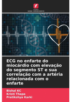 ECG no enfarte do miocárdio com elevação do segmento ST e sua correlação com a artéria relacionada com o enfarte