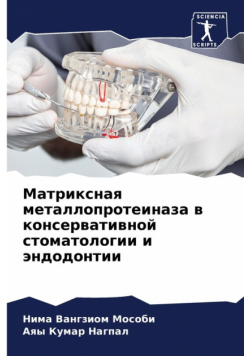 Матриксная металлопротеиназа в консервативной стоматологии и эндодонтии