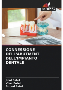 Connessione Dell'abutment Dell'impianto Dentale