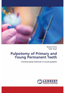 Pulpotomy of Primary and Young Permanent Teeth