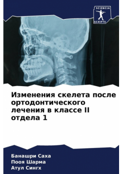 Изменения Скелета После Ортодонтического Лечения В Классе Ii Отдела 1