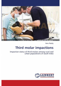 Third molar impactions