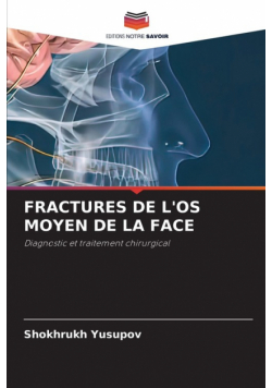 Fractures De L'os Moyen De La Face
