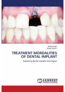 Treatment Mordalities Of Dental Implant