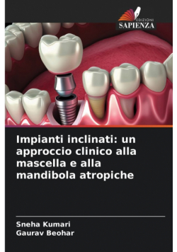 Impianti inclinati