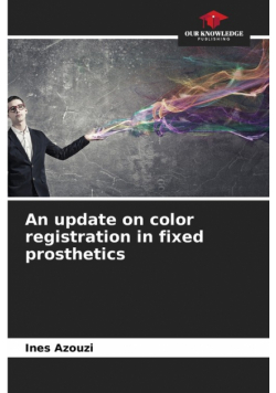 An update on color registration in fixed prosthetics