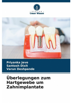 Überlegungen zum Hartgewebe um Zahnimplantate