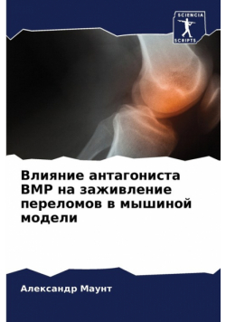Влияние Антагониста Bmp На Заживление Переломов В Мышиной Модели