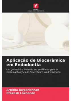 Aplicação de Biocerâmica em Endodontia