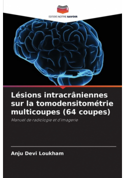 Lésions intracrâniennes sur la tomodensitométrie multicoupes (64 coupes)