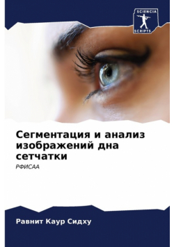 Сегментация и анализ изображений дна сетчатки