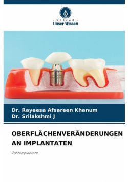 Oberflächenveränderungen An Implantaten