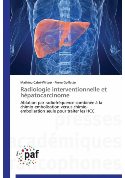 Radiologie interventionnelle et hépatocarcinome