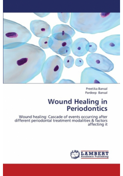 Wound Healing in Periodontics