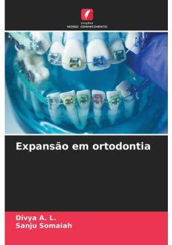 Expansão em ortodontia
