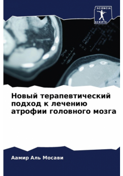 Новый терапевтический подход к лечению атрофии головного мозга