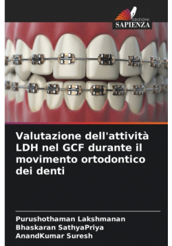 Valutazione dell'attività LDH nel GCF durante il movimento ortodontico dei denti