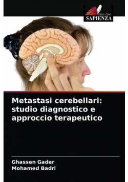 Metastasi cerebellari