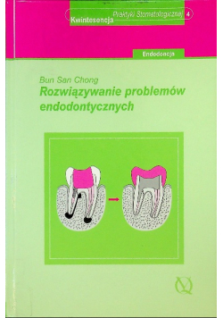 Rozwiązywanie problemów endodontycznych