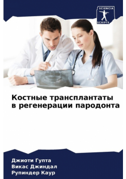 Костные трансплантаты в регенерации пародонта