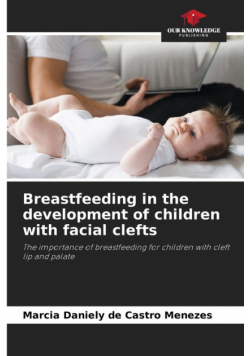 Breastfeeding in the development of children with facial clefts