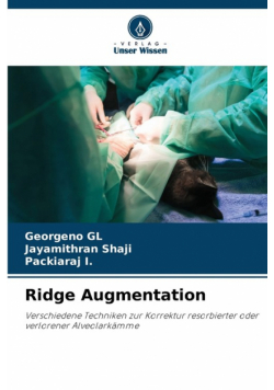 Ridge Augmentation