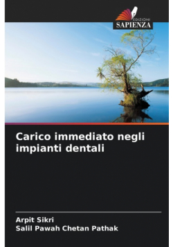 Carico immediato negli impianti dentali