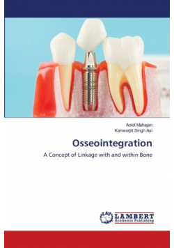 Osseointegration