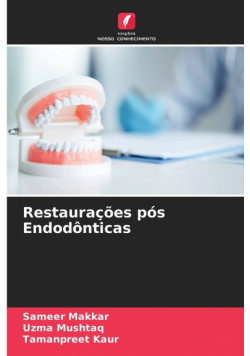 Restaurações pós Endodônticas