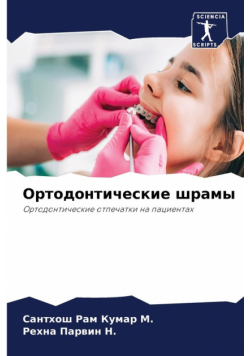 Ортодонтические шрамы