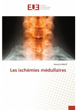 Les ischémies médullaires
