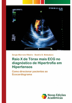 Raio X de Tórax mais ECG no diagnóstico de Hipertrofia em Hipertensos