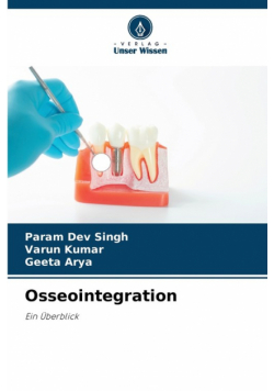 Osseointegration
