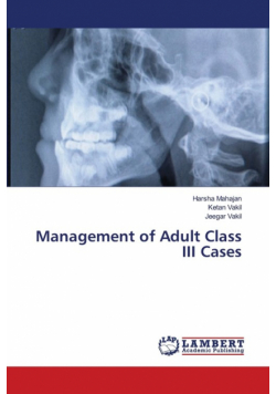 Management of Adult Class III Cases