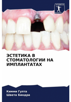 ЭСТЕТИКА В СТОМАТОЛОГИИ НА ИМПЛАНТАТАХ